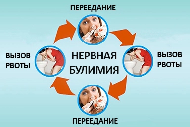 Лечение булимии в Веневе